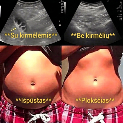 Ricinos aliejaus detoksikacijos rinkinys